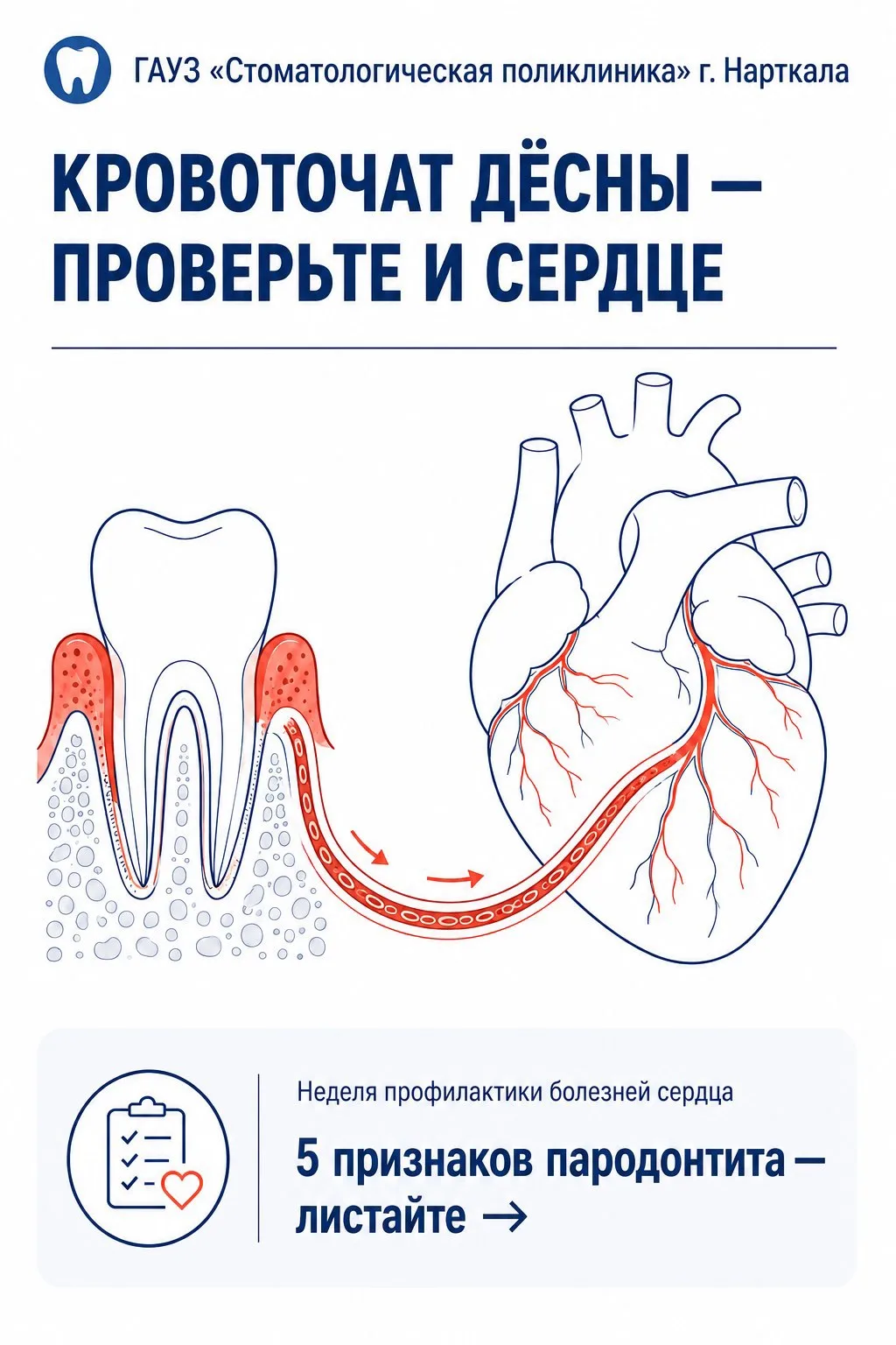 Кровоточат дёсны? Проверьте и сердце