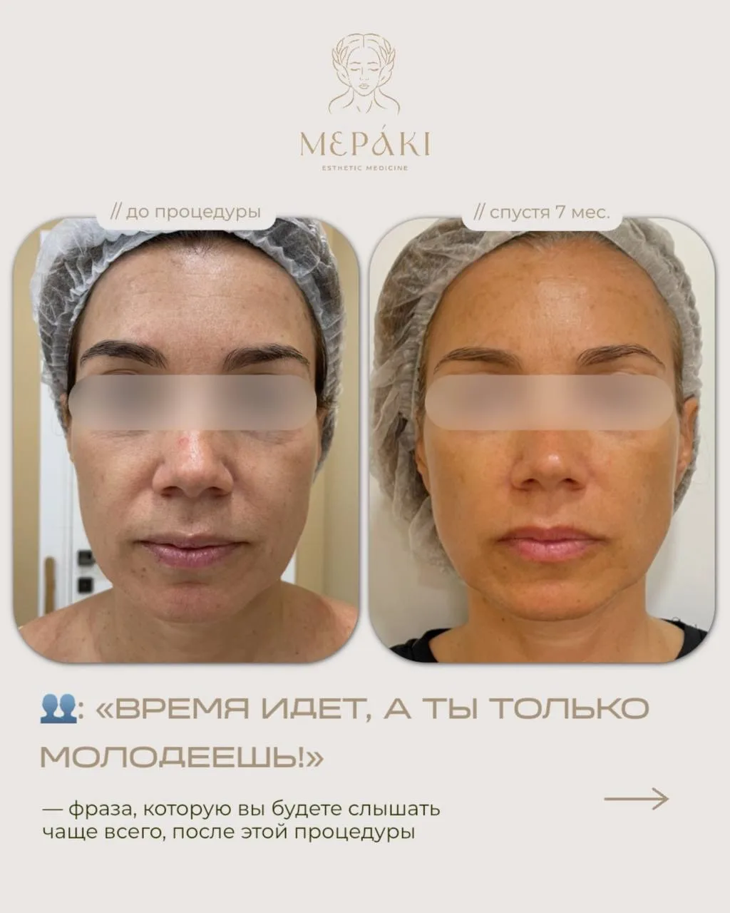 Как остановить время? Записаться к нам на процедуру Fotona 4D 🙃
