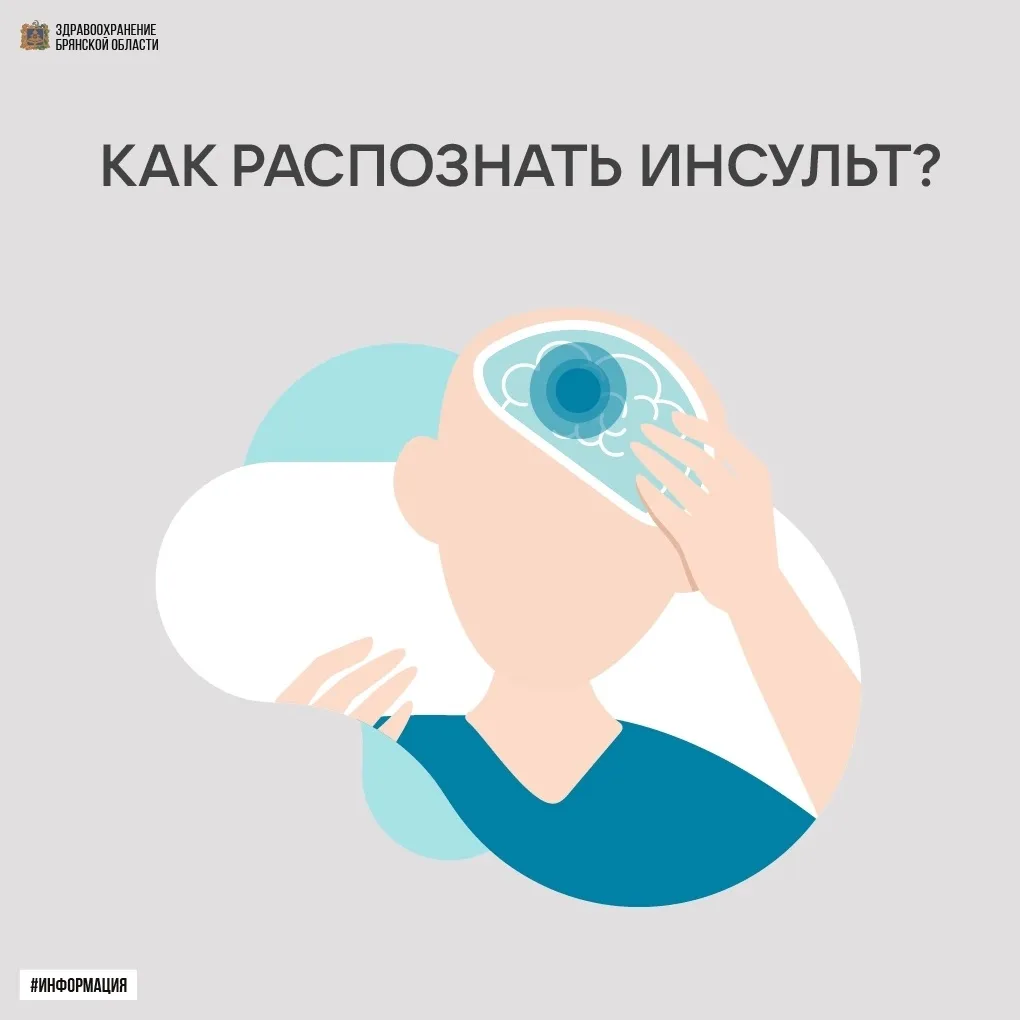 🧠🚨 Как распознать инсульт?
