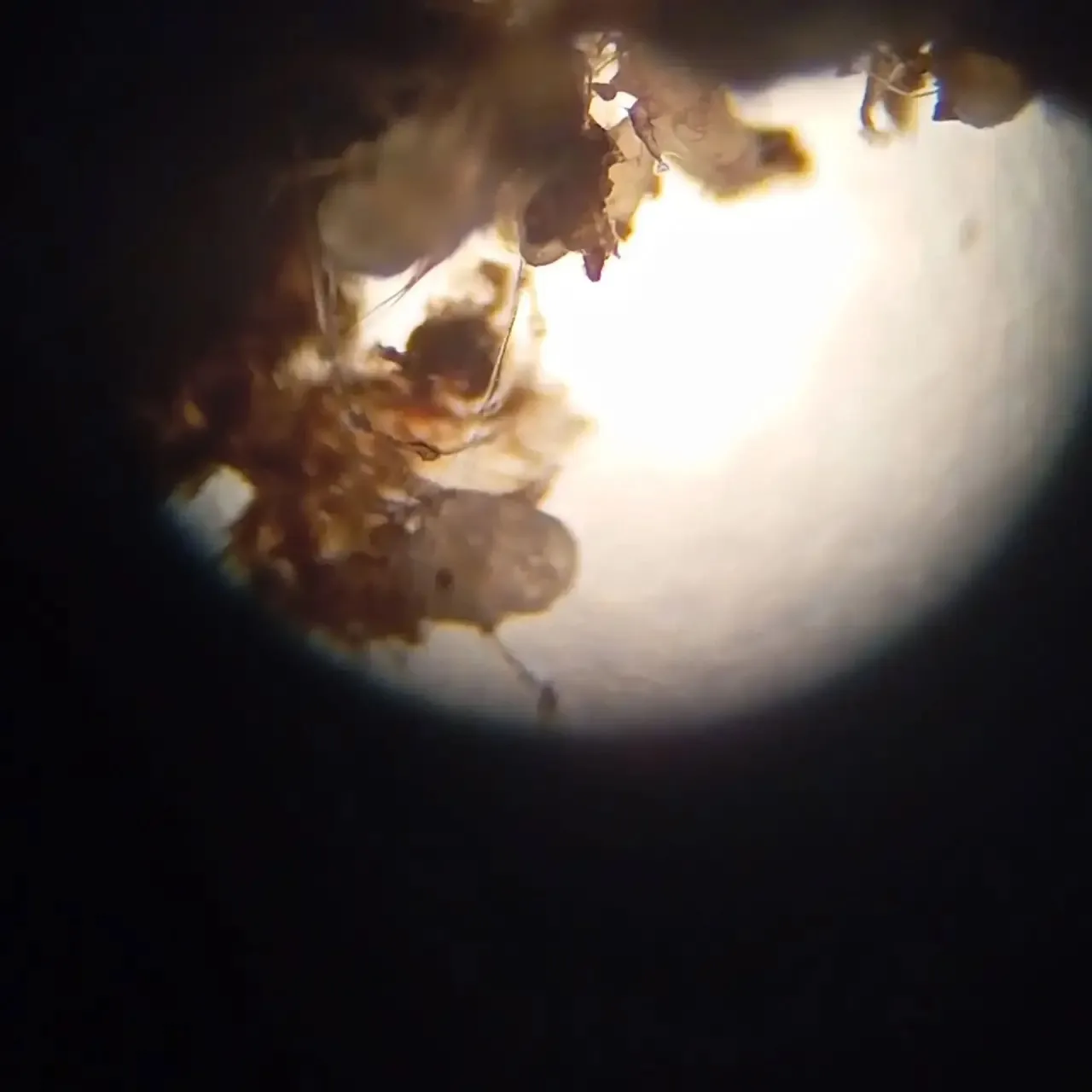 Когда в ушах не просто грязь 👂🔬