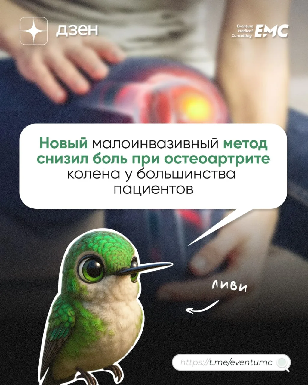 #статья #дзен

Новый малоинвазивный метод снизил боль при остеоартрите колена у большинства пациенто