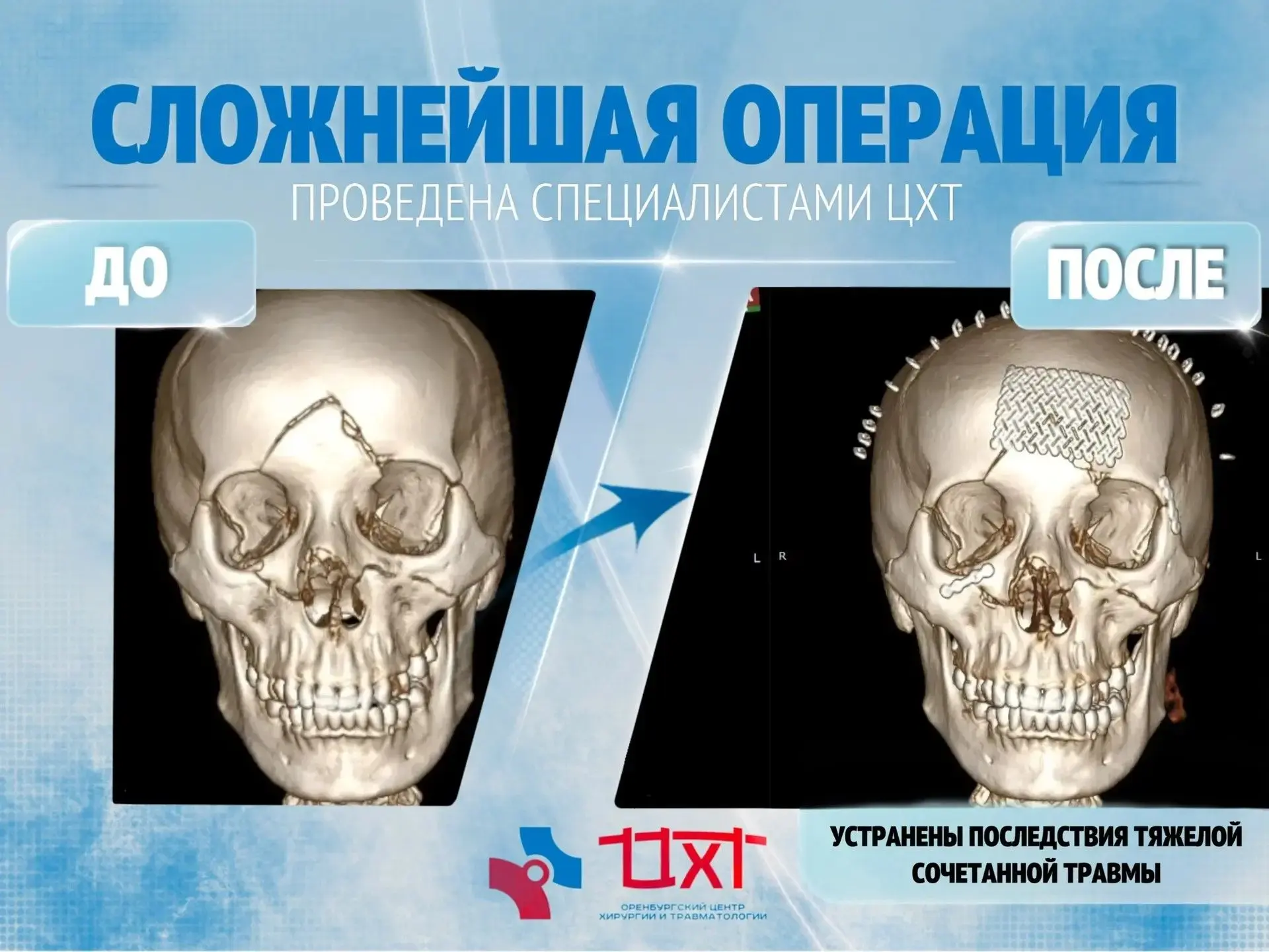 Пациентка К., 40 лет, доставлена в приёмное отделение ООКЦХТ в крайне тяжёлом состоянии...
