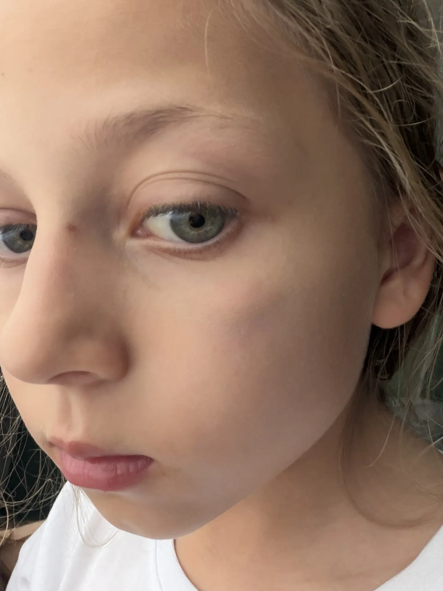 У Евы теперь фингал под глазом 😢

Хотела сделать сальто на батуте, но в итоге собственным коленом п