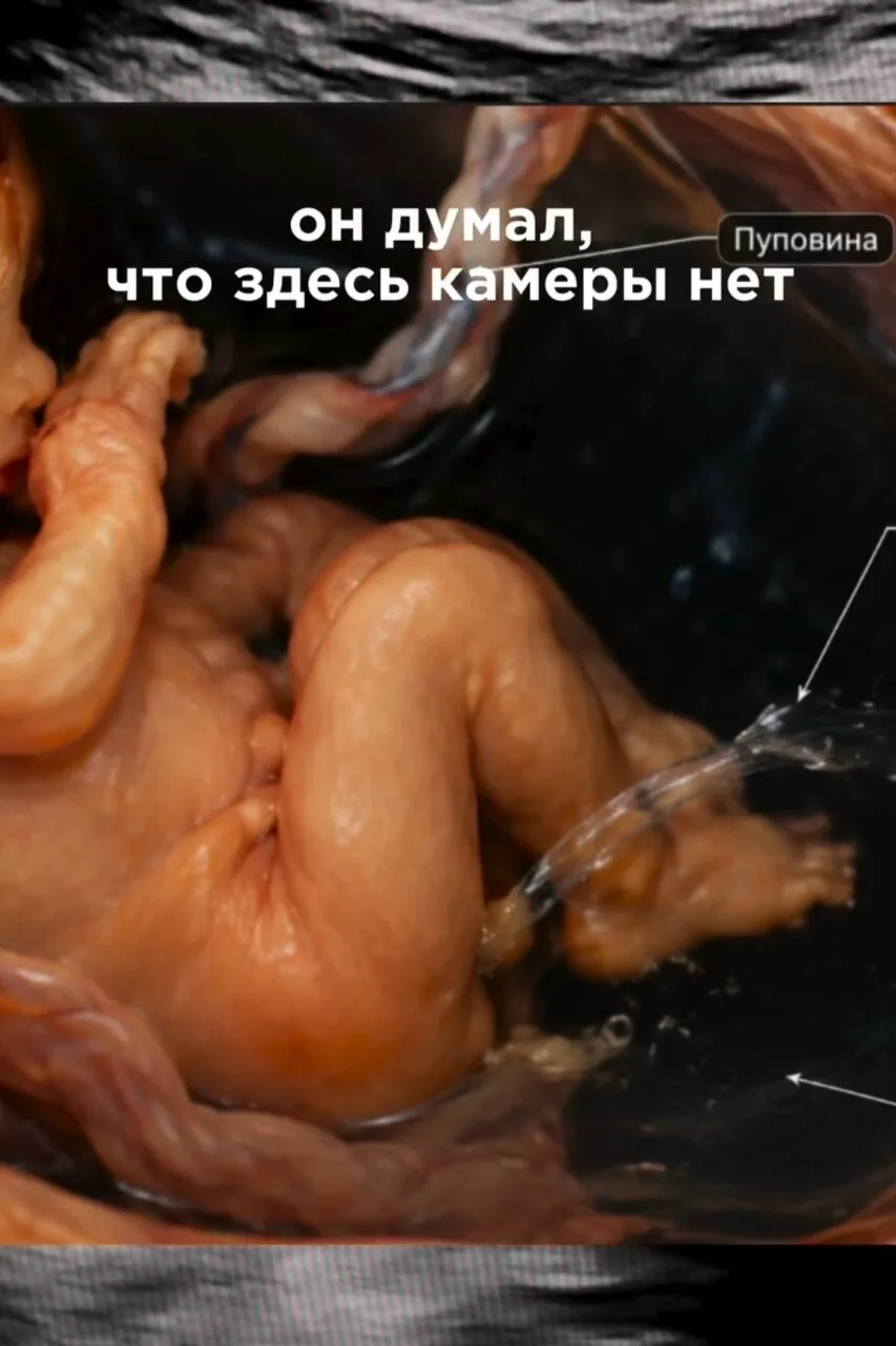 Да, малыш действительно писает в околоплодные воды 😂