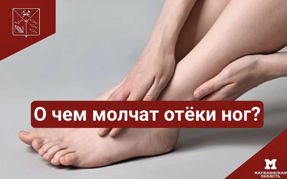 О чем молчат отёки ног?🦶