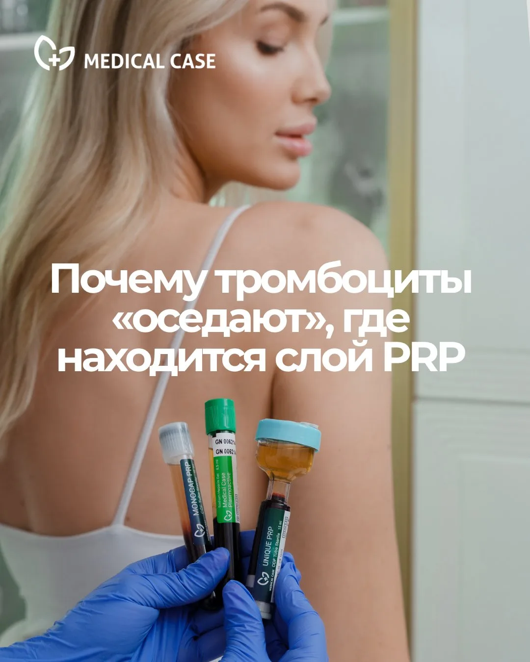 Почему тромбоциты «оседают»: где находится слой PRP?

Где находится слой PRP после центрифугирования