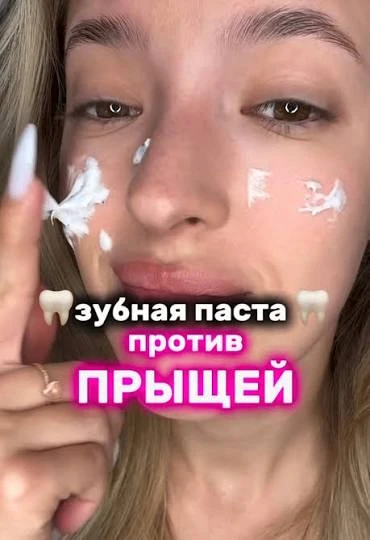 Тут пациентка приходит, жалуется на прыщи которые уже месяц лечит зубной пастой на ночь — метод от п
