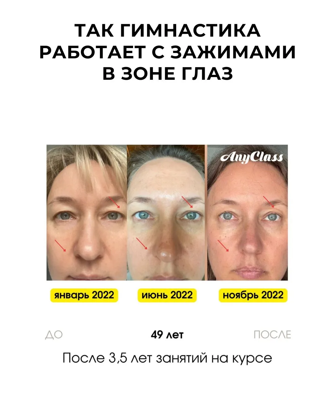 Изображение 1 к публикации «Гимнастика для лица»