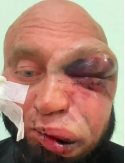 В Новосибирске задержали двоих за жестокое избиение у бара