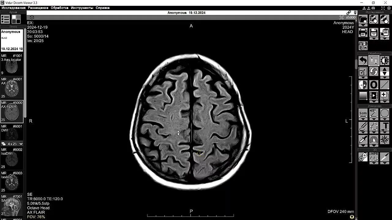 Немного анатомии головного мозга на МРТ 🧠