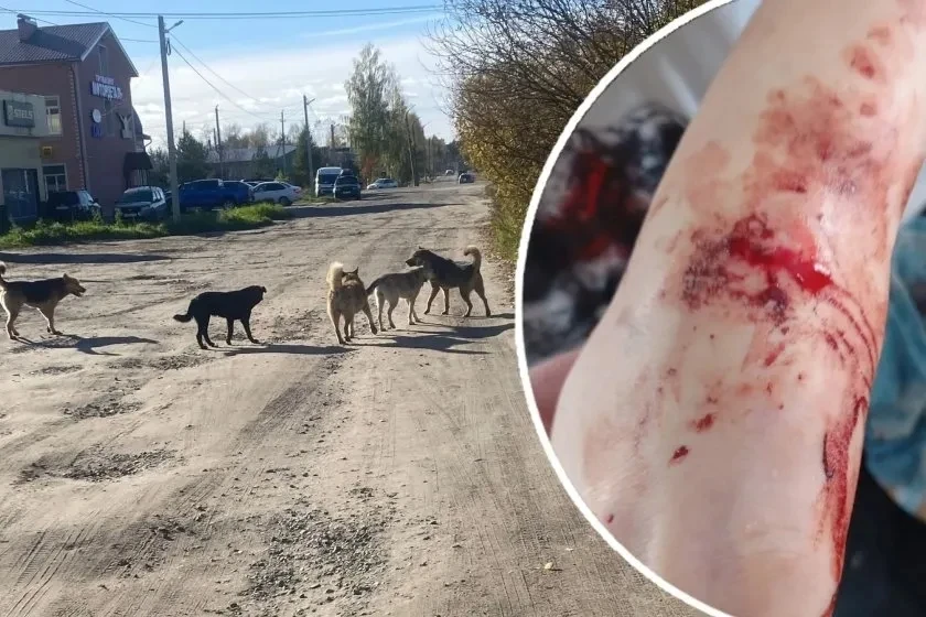 🐕 В Шарье проверяют сообщения о нападениях бездомных собак на детей.