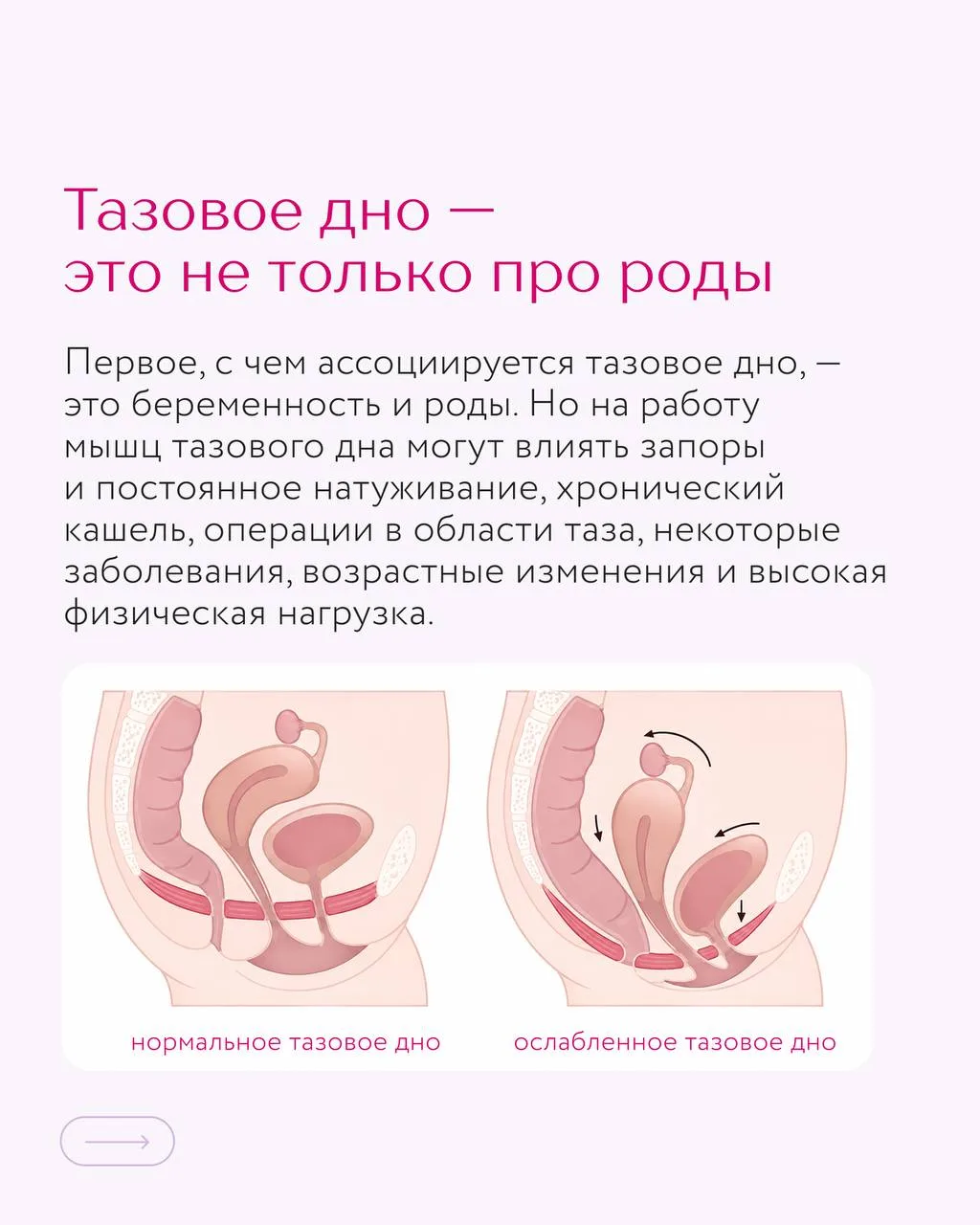 Есть мышцы, о существовании которых мы вспоминаем, только когда они начинают мешать жит...
