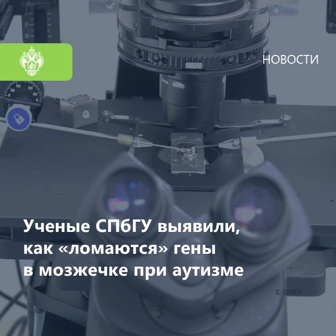Нейробиологи Санкт‑Петербургского государственного университета сравнили работу здорово...
