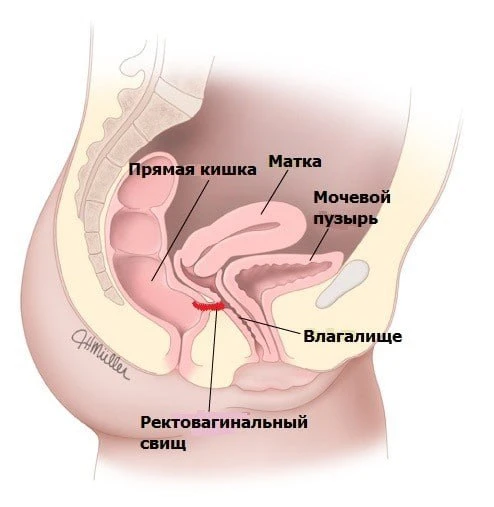 🦠ОТКУДА В МАЗКЕ КИШЕЧНАЯ ПАЛОЧКА?
