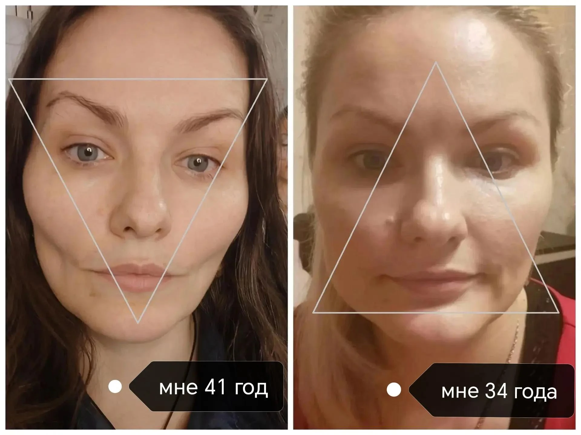 Почему с возрастом лицо меняет форму? И при чём тут кости черепа
