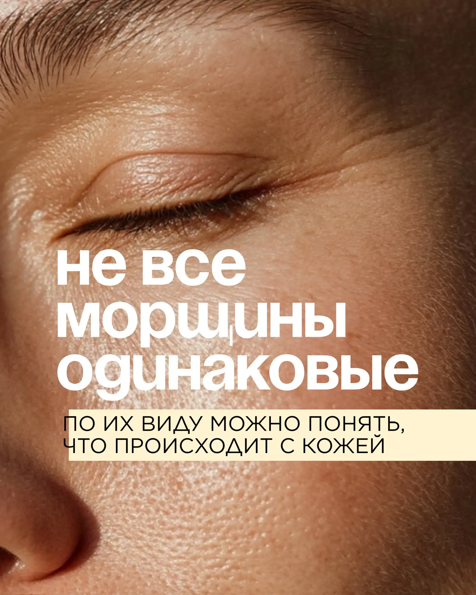 Морщины – это не всегда история про возраст.

💧 На то, как выглядит кожа, влияют разные факторы: ур