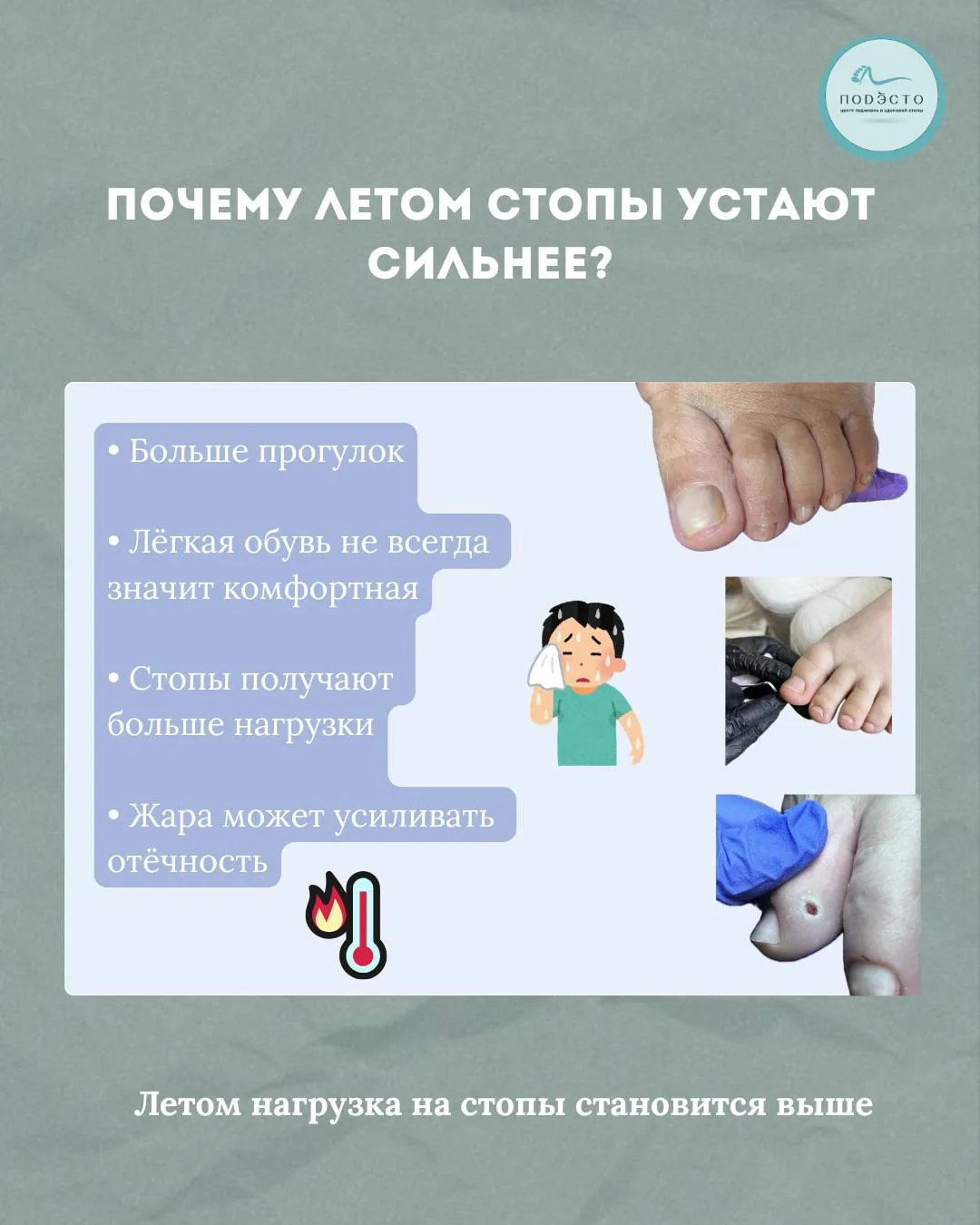 Почему летом стопы устают сильнее?

Летом многие замечают, что к вечеру стопы устают сильнее обычног