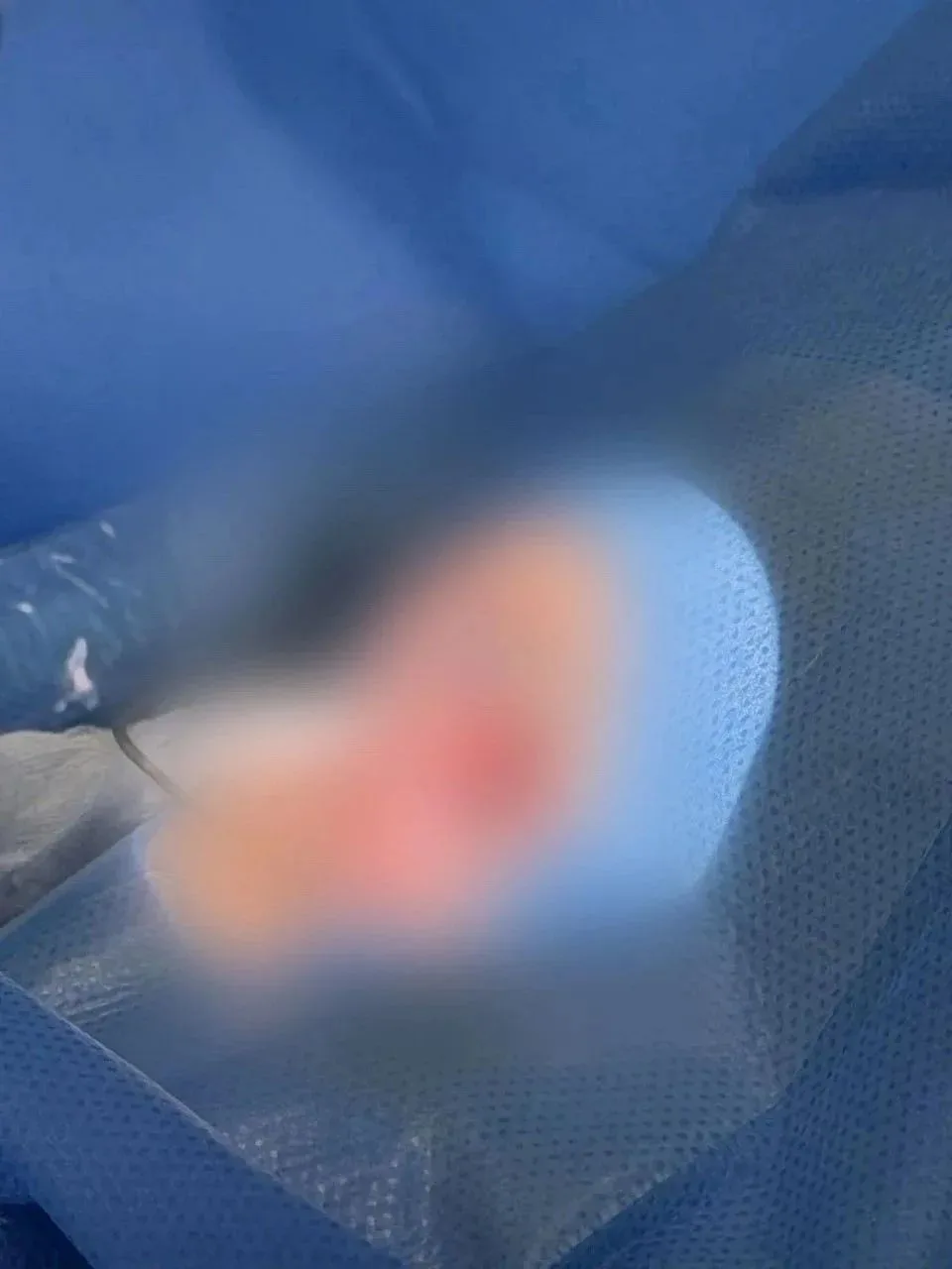 ⚡️В ДРКБ спасли зрение шестилетнему мальчику после тяжёлой травмы