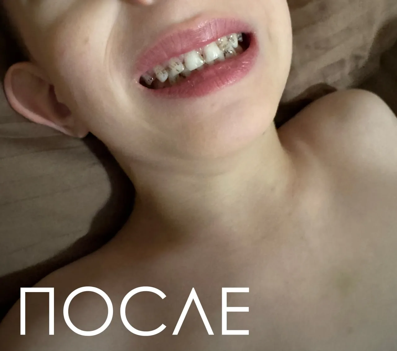 Какой-то непонятный налет на зубах у мальчика 5 лет