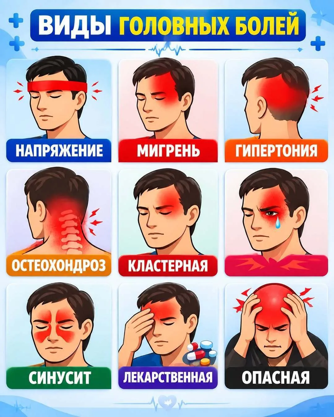 ▎Оcнoвныe виды гoлoвнoй бoли