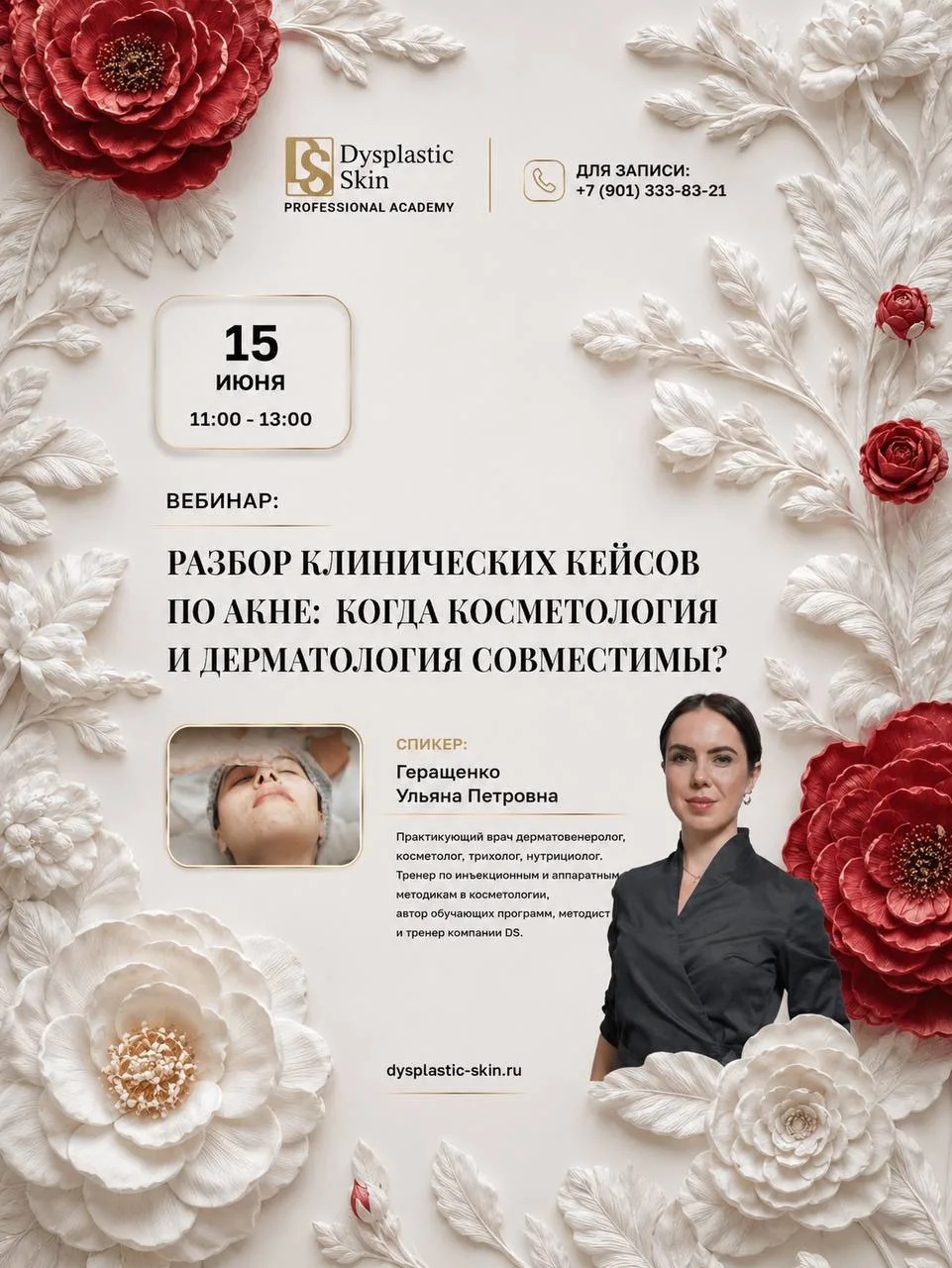 Дорогие коллеги, напоминаем, уже сегодня в 11:00 вебинар: 
«Разбор клиничскихкейсов по акне: когда к