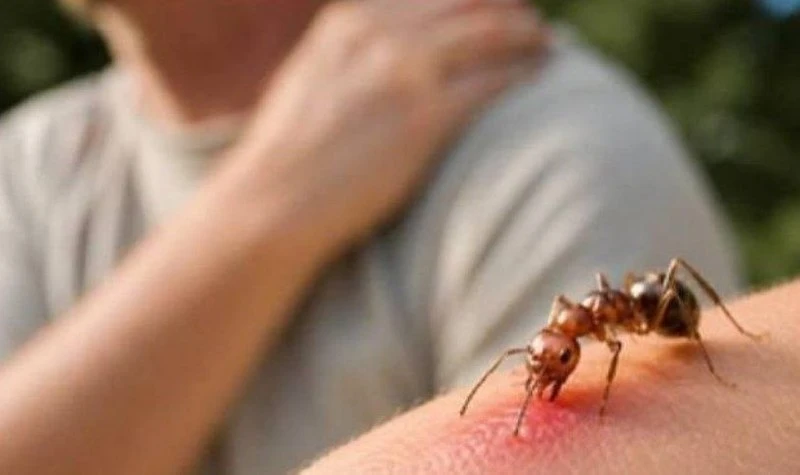 🐜 Укус даже обычного муравья может привести к смерти, предупреждают врачи

У некоторых людей скрыта