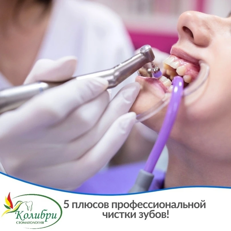 5 плюсов профессиональной чистки зубов!
