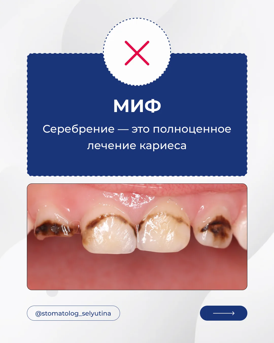 Знали о серебрении?