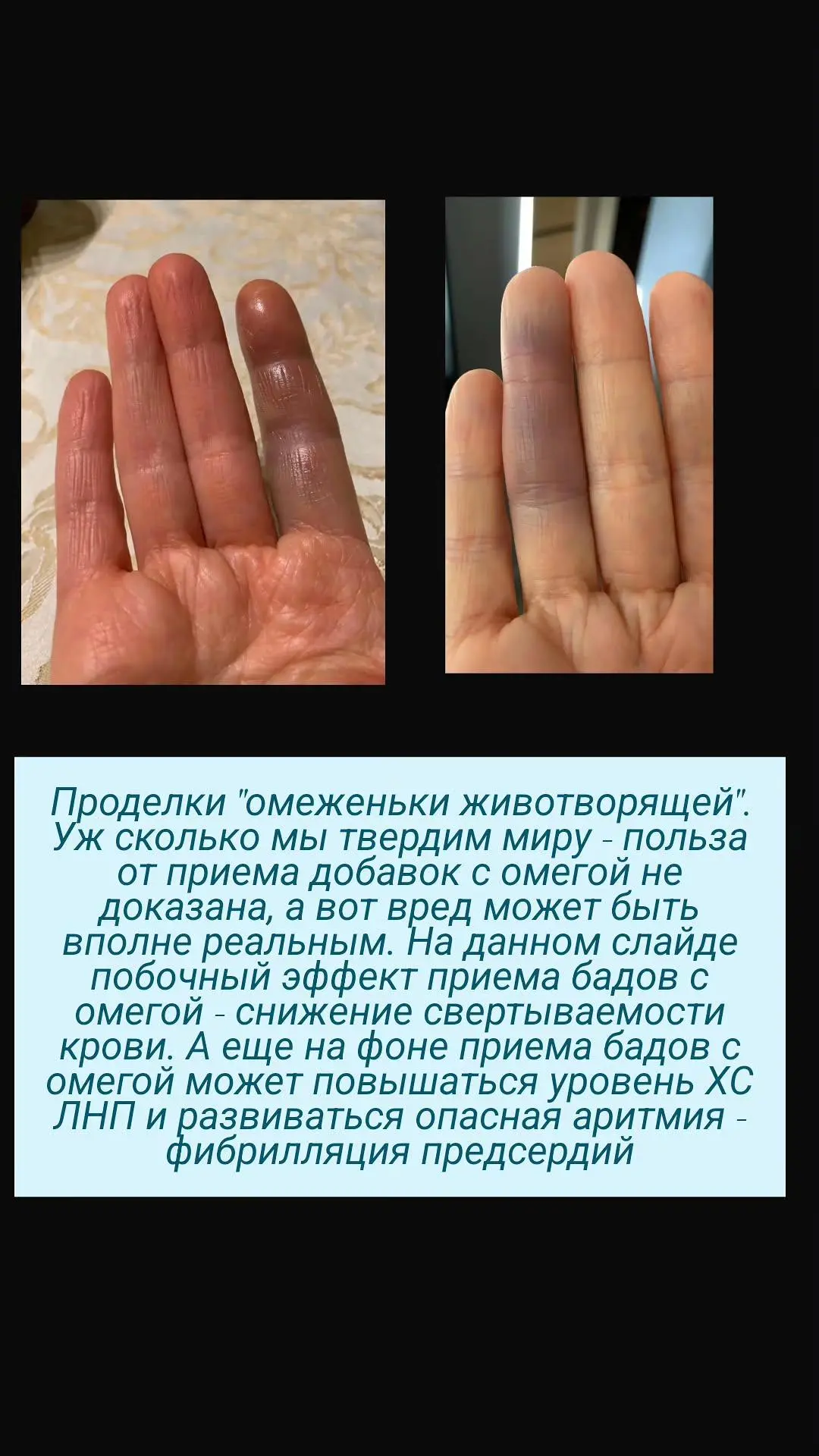 Вечерний кардиопривет, мои любимые котики♥️