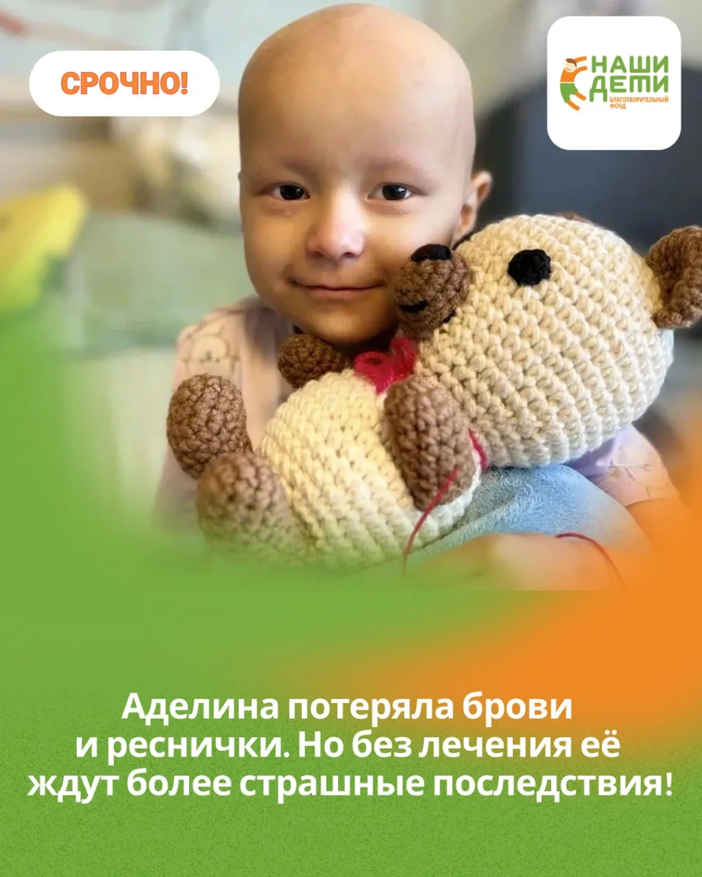 💔 Аделина потеряла брови и реснички. Но без лечения её ждут более страшные последствия...