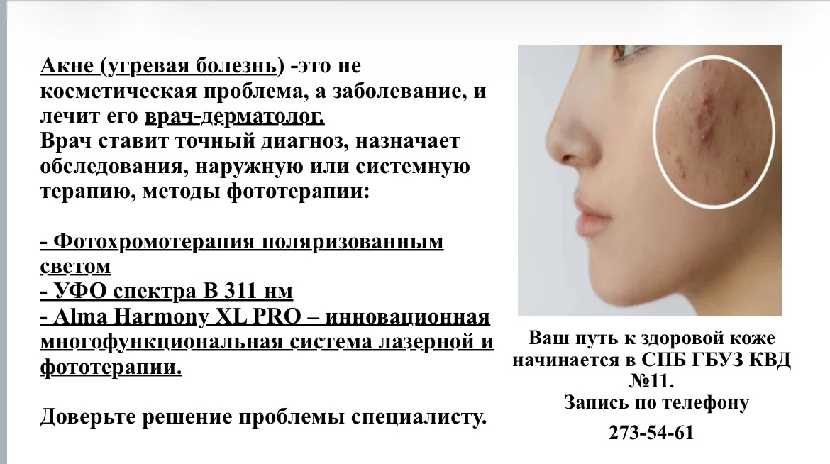 Телефон для записи в СПБ ГБУЗ КВД № 11 :