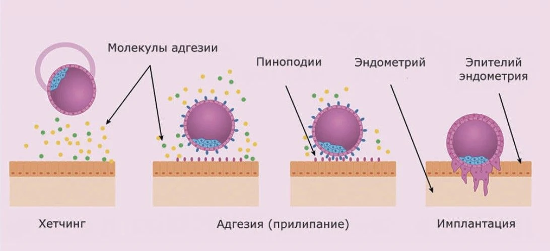 Как определить "время" окна имплантации?

Маркеры окна имплантации делятся на несколько групп — от в