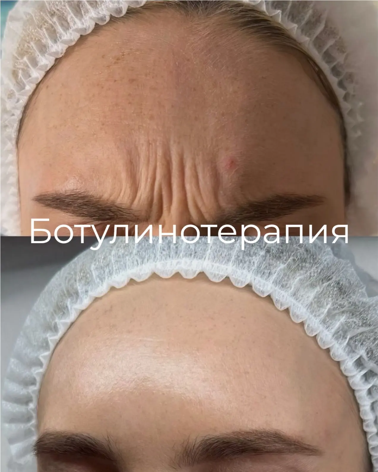 Кто куда, а мы к любимому косметологу. Можем записать вас на консультацию🥰