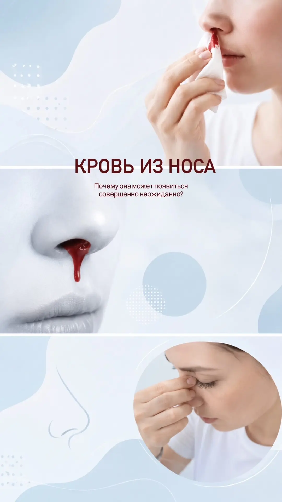 Кровь из носа — знакомая многим ситуация.