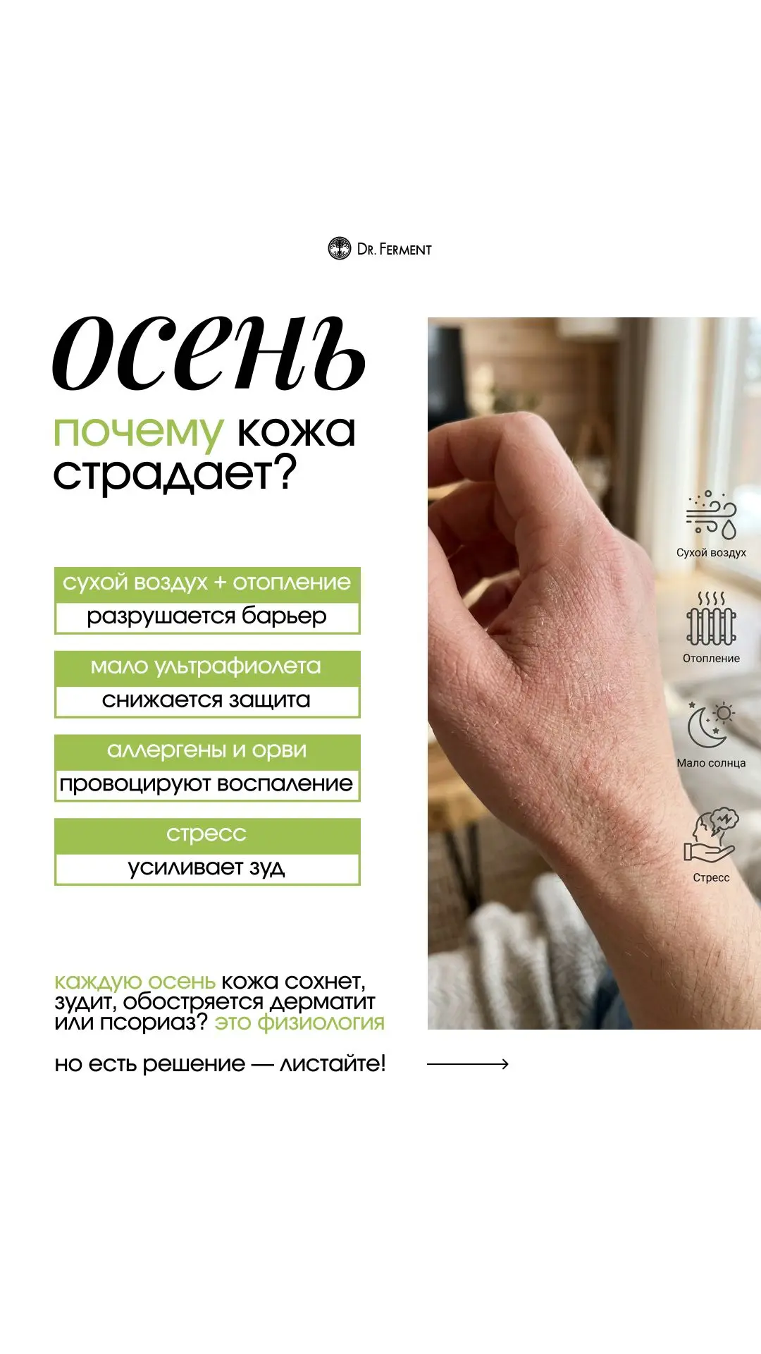 Сухость, зуд, раздражения — это физиология. Батареи, ветер и стресс разрушают защитный ...