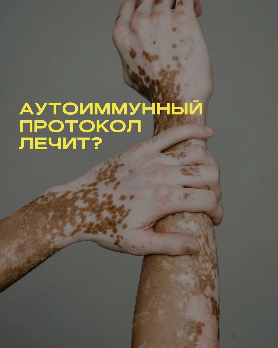 AIP одна из самых обсуждаемых диет при аутоиммунных заболеваниях.