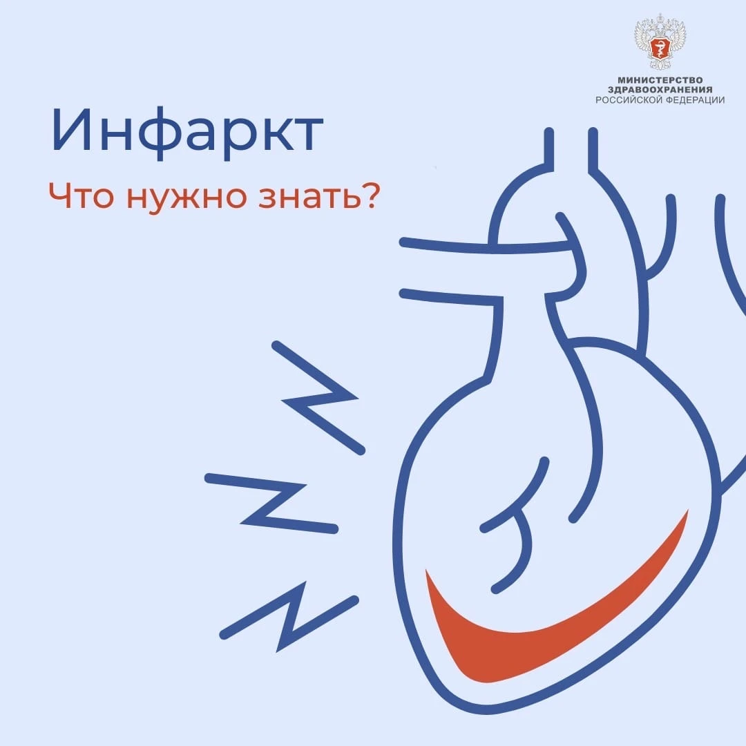 Что нужно знать об инфаркте