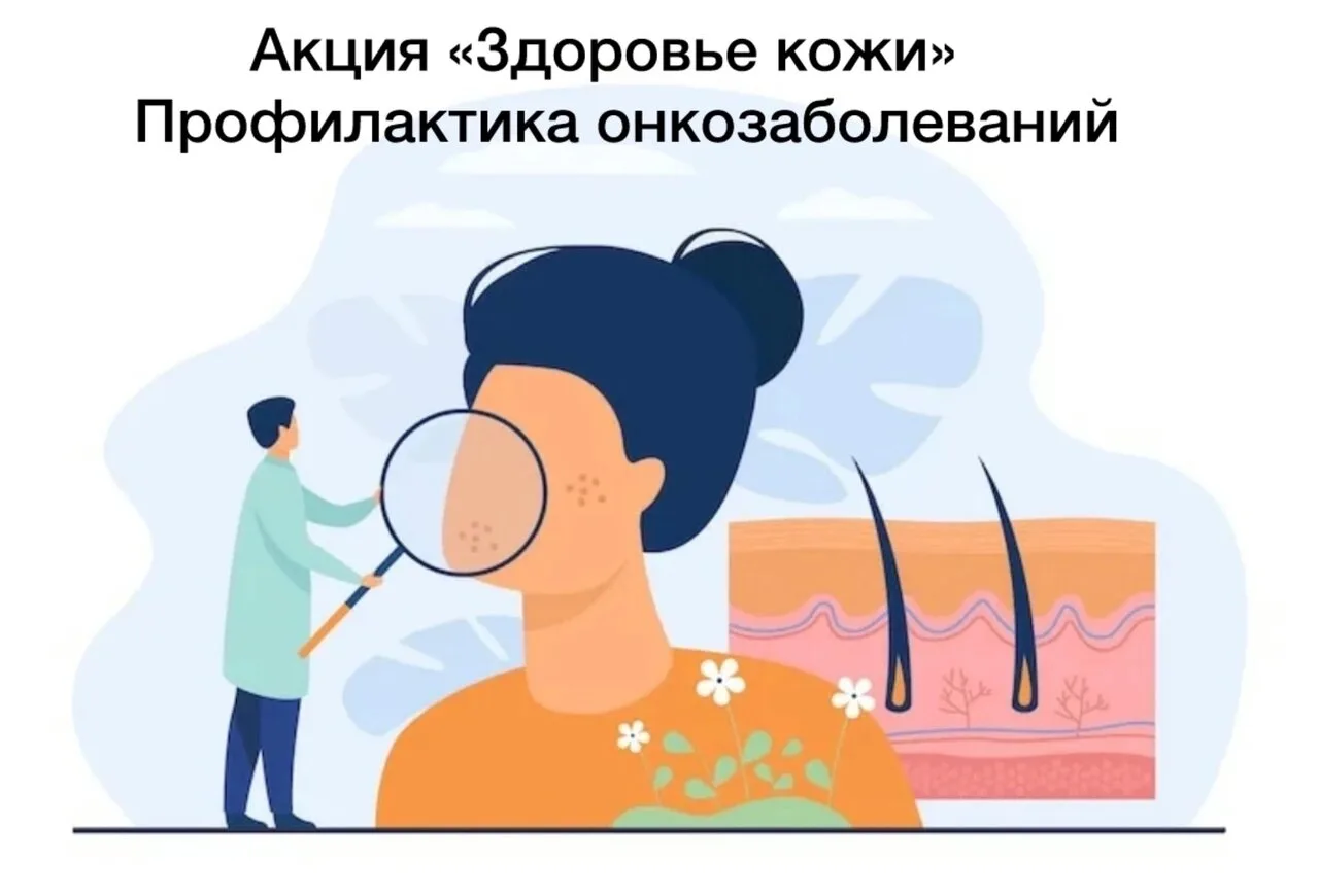 ⠀⠀🔥 Акция «Здоровье кожи. Профилактика онкозаболеваний» пройдёт 6 июня