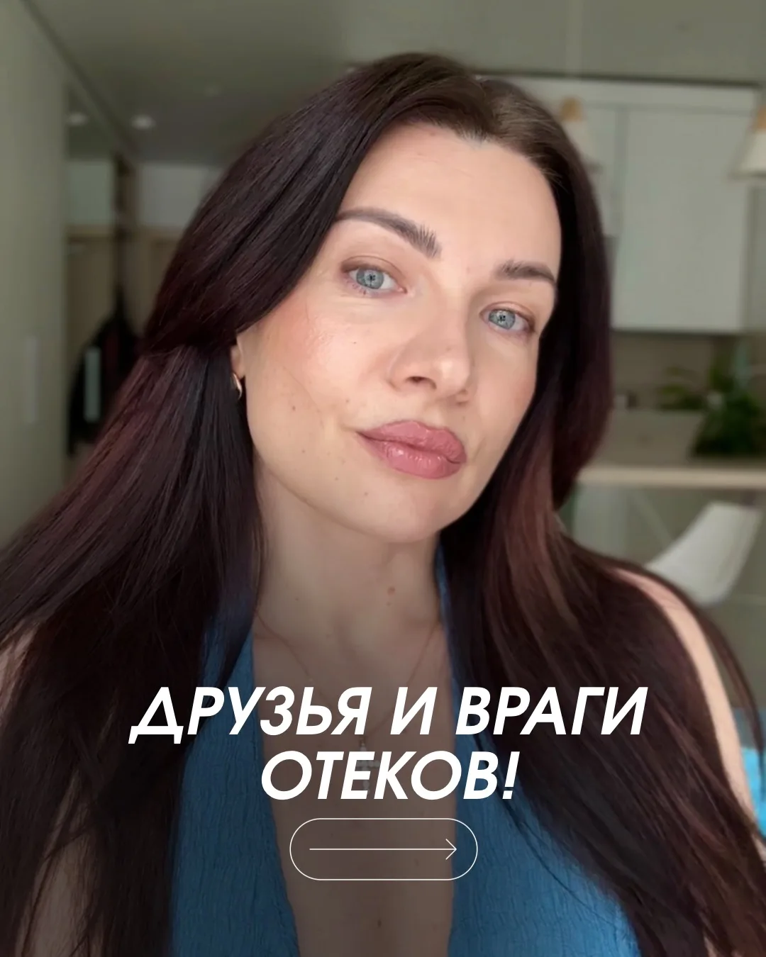 Друзья и враги отеков❗️