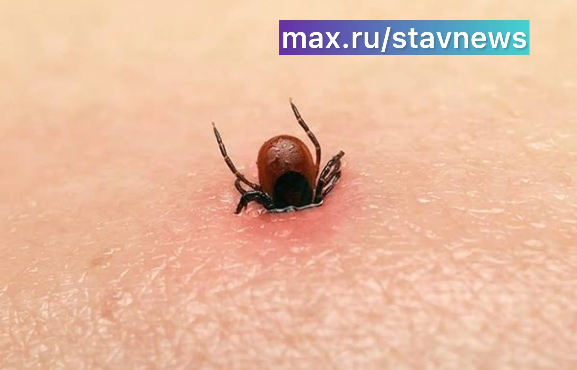 Будьте осторожны! Вчера сняли вот этого урода с тела. Они опять кусают. Начался второй ...