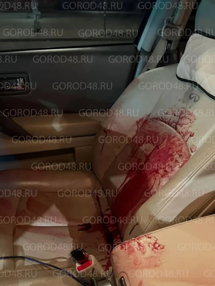 🚨 Липецкая семья хотела помочь подростку на мотоцикле — мужа женщины сбили, а потом не...