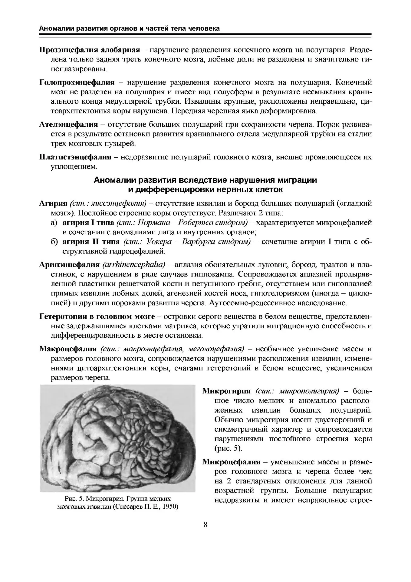 Аномалии развития ЦНС