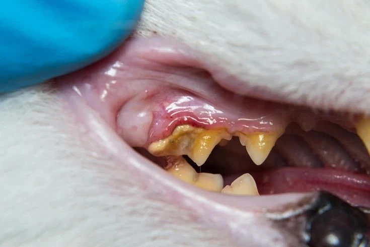 Зубной камень🦷