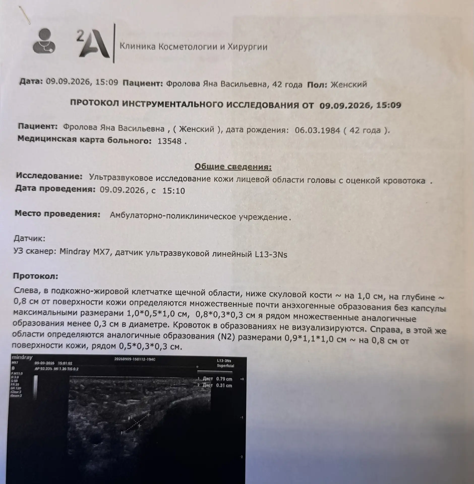Что показало УЗИ.