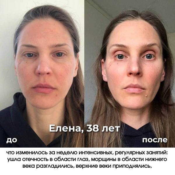 💬 "Да это свет… фильтры… уколы…  Девчонки, мне это пишут под каждым до-после.  И особенно — под резу