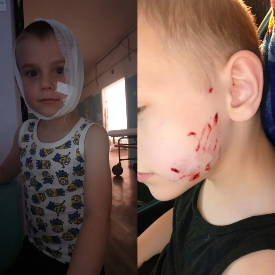 😱В селе Приволжское Светлоярского района бродячий пёс нанес тяжкие увечья пятилетнему мальчику.

Ин