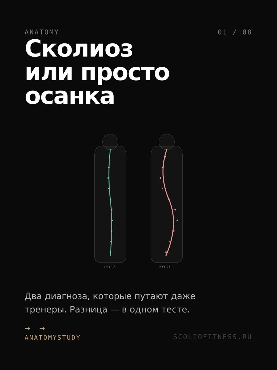 Сколиоз и сколиотическая осанка — два разных состояния. Их путают, и из-за этого работа...