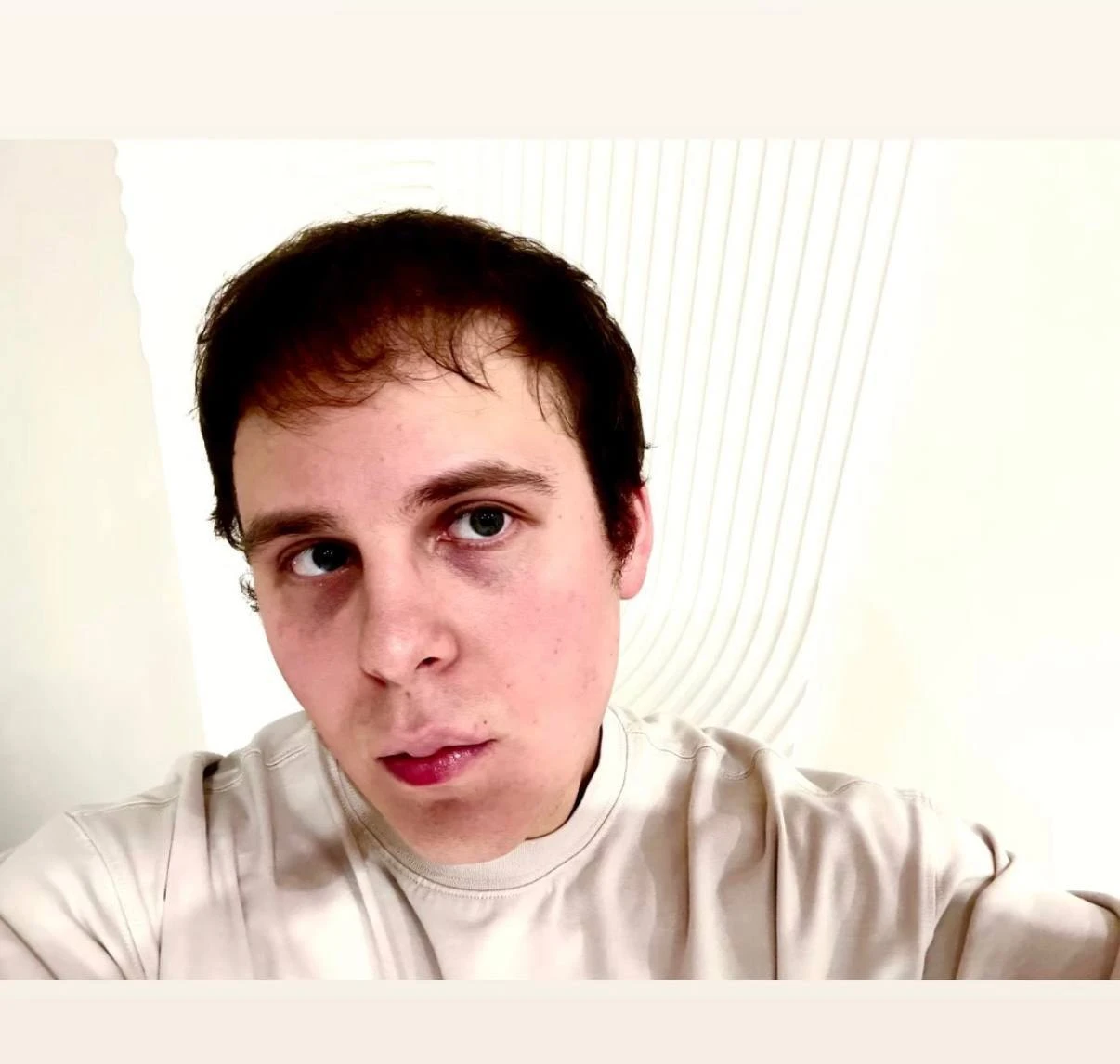 🤩 Toxi$ поделился результатами похудения