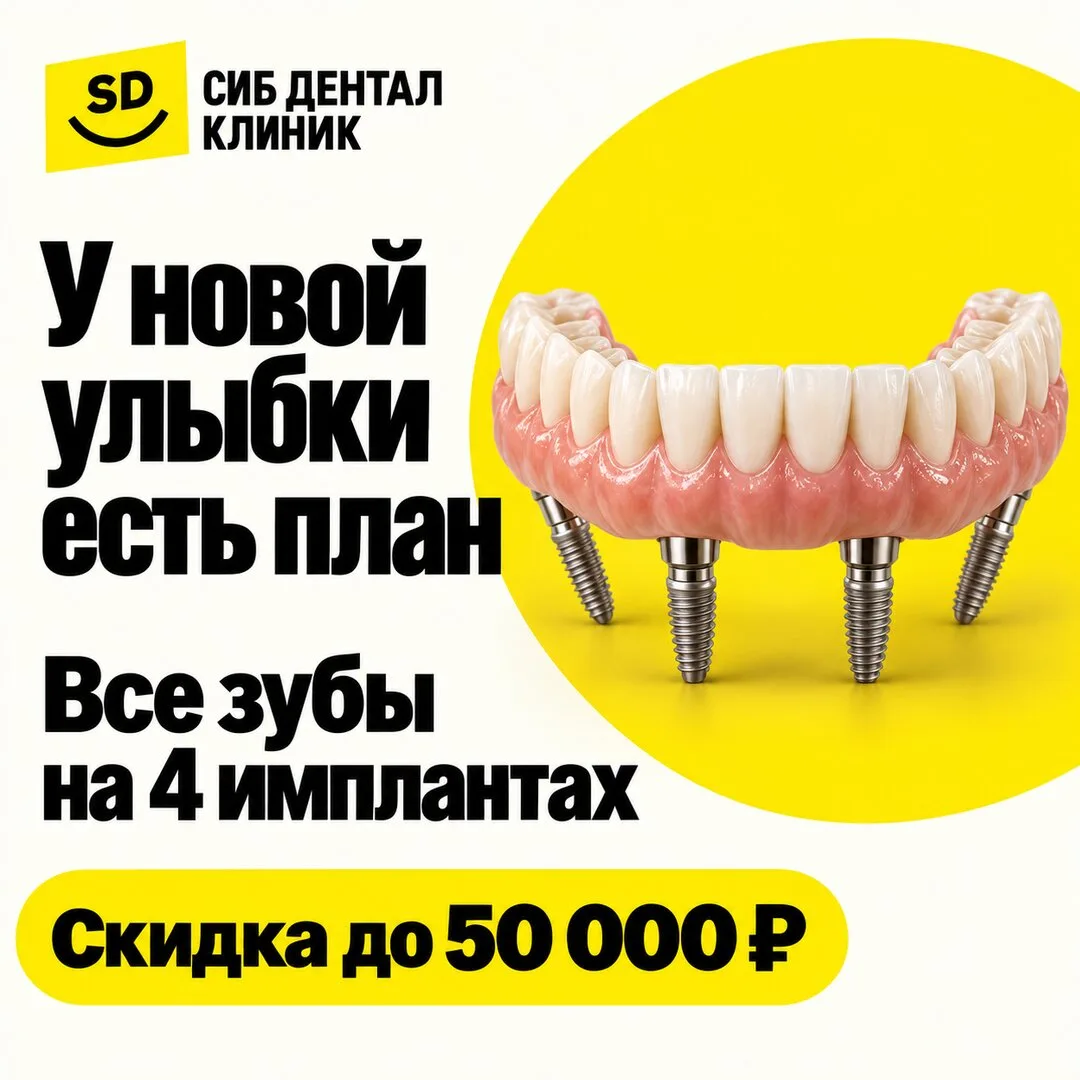 Все зубы на 4 имплантах. Улыбка начинается с плана!