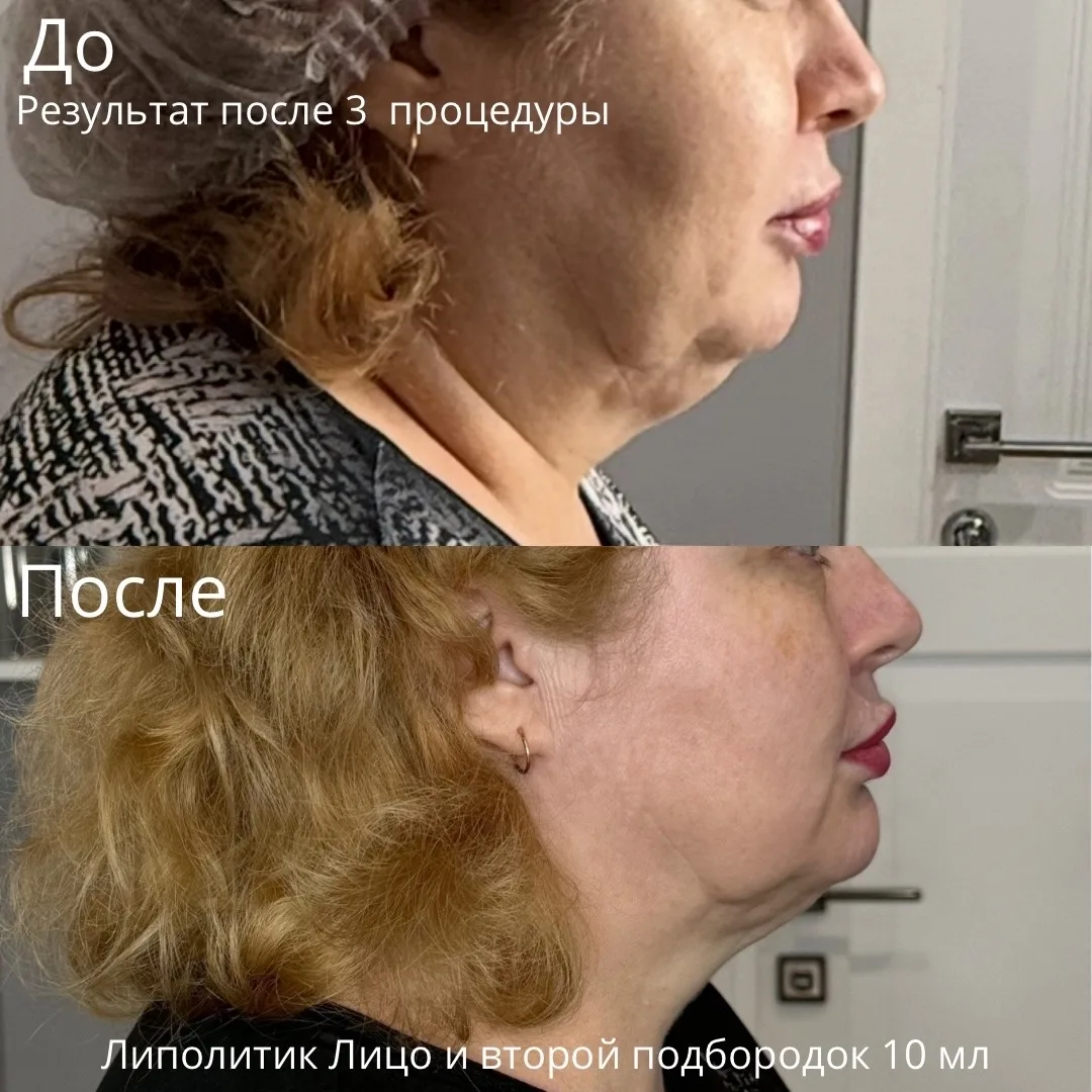 ‼ Супер предложение, от которого невозможно отказаться 💥 ‼